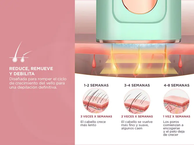 Depiladora Láser IPL Care By Gadnic Flyz - Portátil 5 Niveles de Potencia Uso Unisex Tecnología de Luz Pulsada - Imagen 4